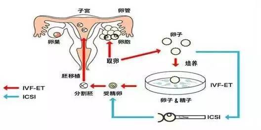 来例假可以喝咖啡吗？ 经期喝咖啡的6个好处