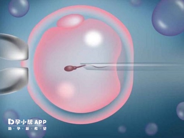 12周nt男宝特点男孩 怀孕12周胎儿高清图